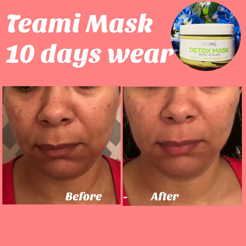 Teami Detox Mask Review On Sensitive Skin Before After